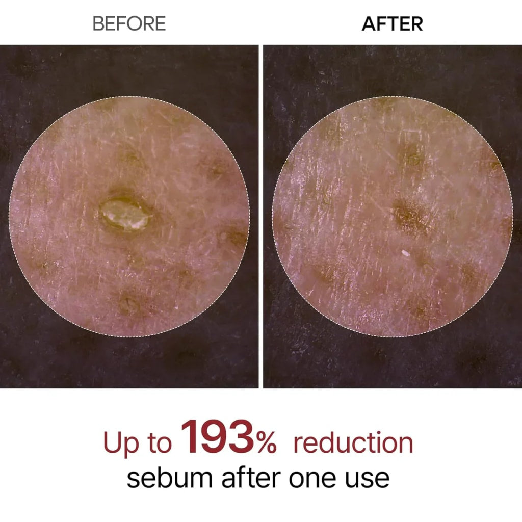 Rice Peel Shot Ampoule™