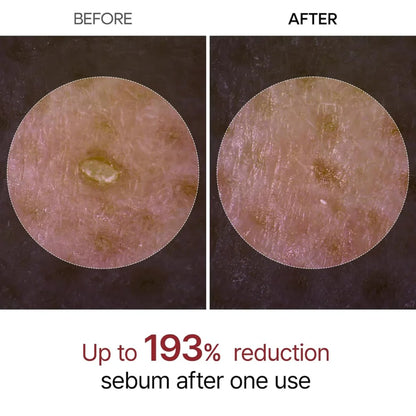 Rice Peel Shot Ampoule™